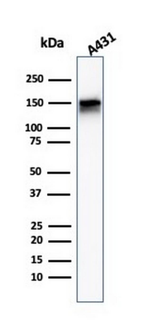 EGFR (Epidermal Growth Factor Receptor) Antibody in Western Blot (WB)