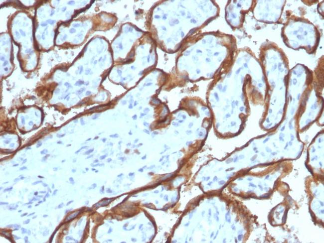 EGFR (Epidermal Growth Factor Receptor) Antibody in Immunohistochemistry (Paraffin) (IHC (P))