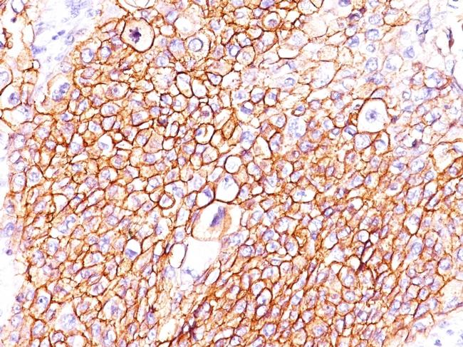 EGFR (Epidermal Growth Factor Receptor) Antibody in Immunohistochemistry (Paraffin) (IHC (P))