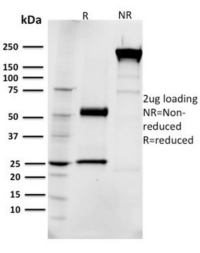 EGFR (Epidermal Growth Factor Receptor) Antibody in SDS-PAGE (SDS-PAGE)