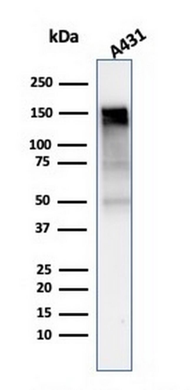 EGFR (Epidermal Growth Factor Receptor) Antibody in Western Blot (WB)