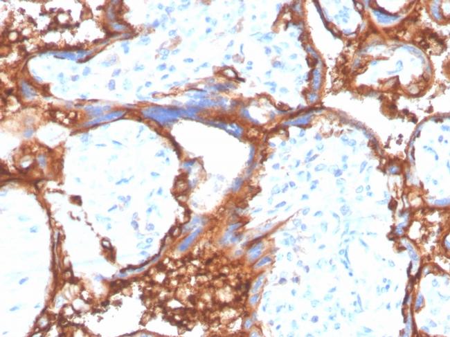 EGFR (Epidermal Growth Factor Receptor) Antibody in Immunohistochemistry (Paraffin) (IHC (P))