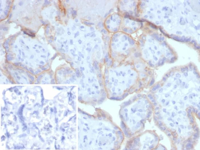 EGFR (Epidermal Growth Factor Receptor) Antibody in Immunohistochemistry (Paraffin) (IHC (P))