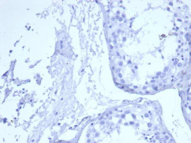 EGFR (Epidermal Growth Factor Receptor) Antibody in Immunohistochemistry (Paraffin) (IHC (P))