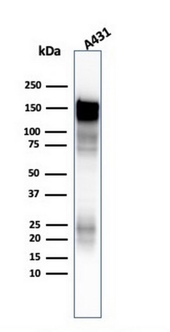 EGFR (Epidermal Growth Factor Receptor) Antibody in Western Blot (WB)