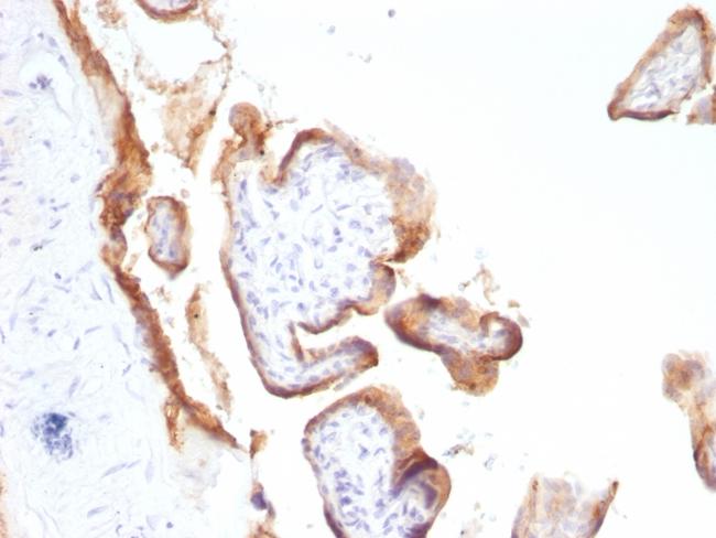 EGFR (Epidermal Growth Factor Receptor) Antibody in Immunohistochemistry (Paraffin) (IHC (P))