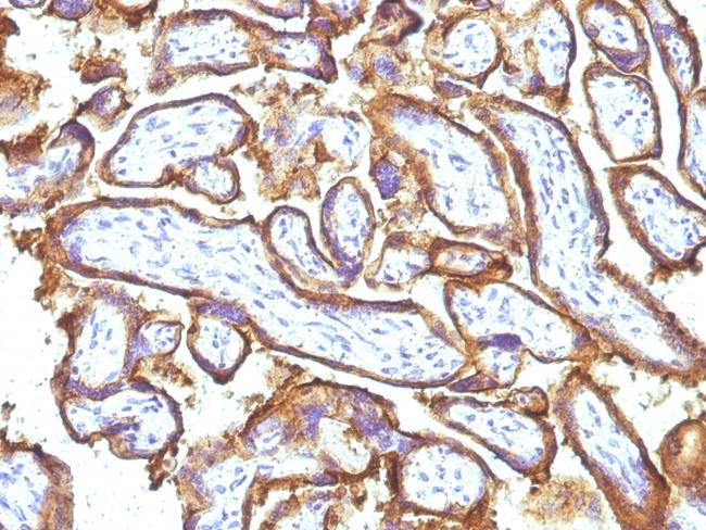 EGFR (Epidermal Growth Factor Receptor) Antibody in Immunohistochemistry (Paraffin) (IHC (P))