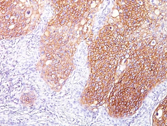 EGFR (Epidermal Growth Factor Receptor) Antibody in Immunohistochemistry (Paraffin) (IHC (P))