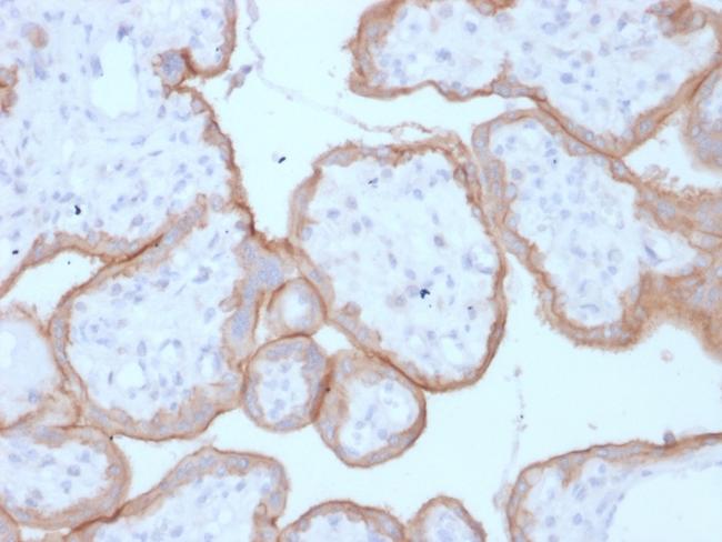 EGFR (Epidermal Growth Factor Receptor) Antibody in Immunohistochemistry (Paraffin) (IHC (P))