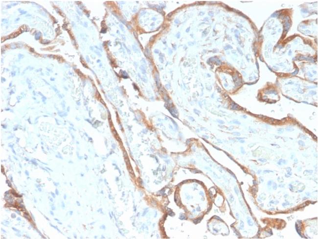 EGFR (Epidermal Growth Factor Receptor) Antibody in Immunohistochemistry (Paraffin) (IHC (P))