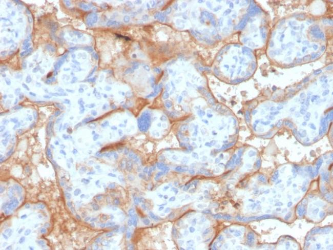 EGFR (Epidermal Growth Factor Receptor) Antibody in Immunohistochemistry (Paraffin) (IHC (P))