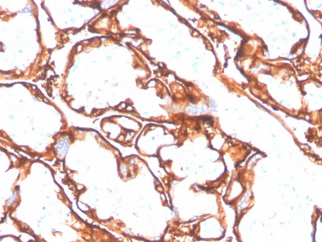 EGFR (L858R Mutant Specific) Antibody in Immunohistochemistry (Paraffin) (IHC (P))