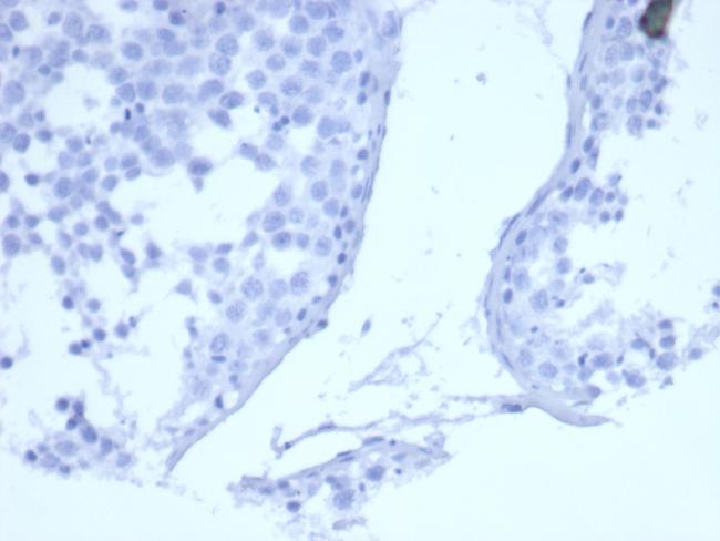 EGFR (Epidermal Growth Factor Receptor) Antibody in Immunohistochemistry (Paraffin) (IHC (P))