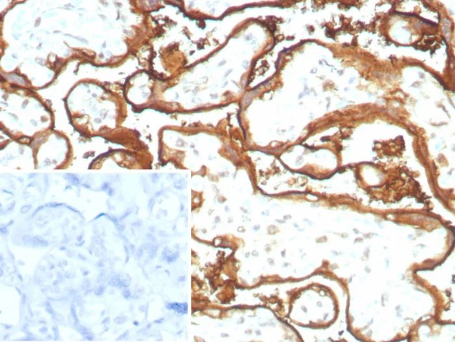 EGFR (Epidermal Growth Factor Receptor) Antibody in Immunohistochemistry (Paraffin) (IHC (P))