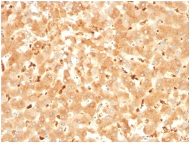 Alpha-2-Macroglobulin Antibody in Immunohistochemistry (Paraffin) (IHC (P))