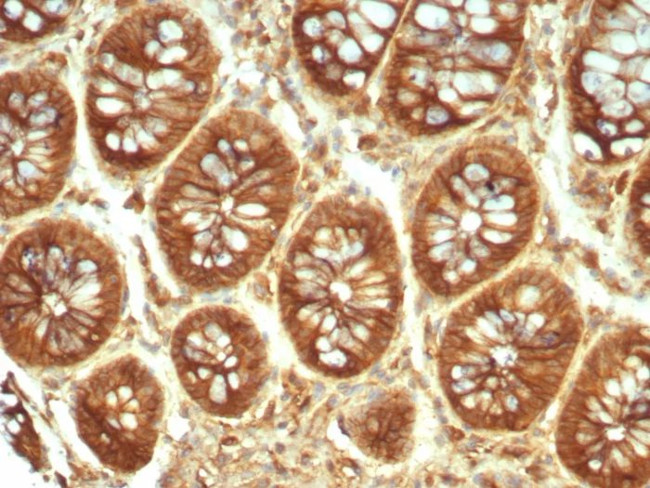 Alpha-2-Macroglobulin Antibody in Immunohistochemistry (Paraffin) (IHC (P))