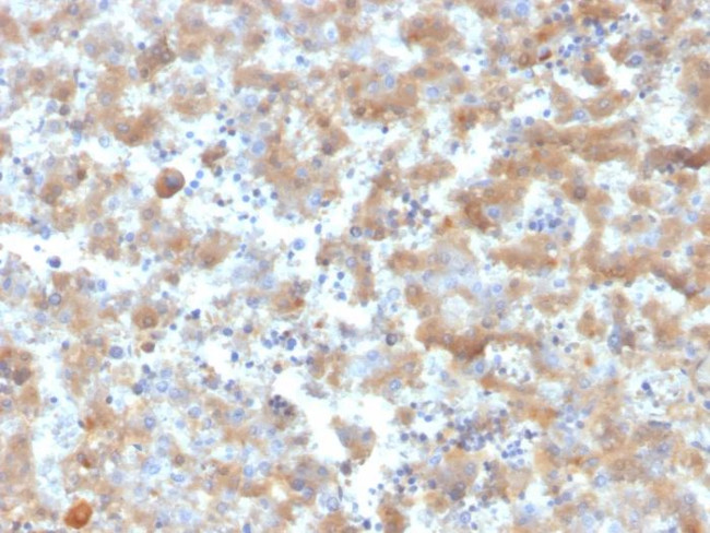 Alpha-2-Macroglobulin Antibody in Immunohistochemistry (Paraffin) (IHC (P))