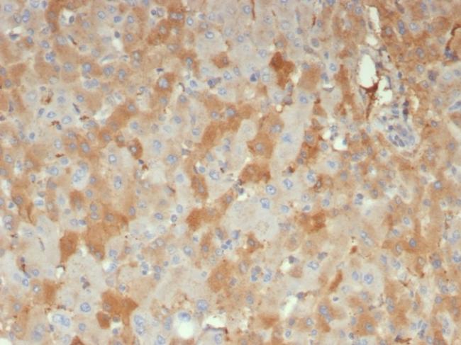 Alpha-2-Macroglobulin/A2M Antibody in Immunohistochemistry (Paraffin) (IHC (P))