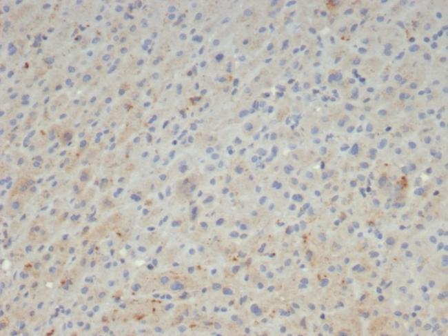 Alpha-2-Macroglobulin/A2M Antibody in Immunohistochemistry (Paraffin) (IHC (P))