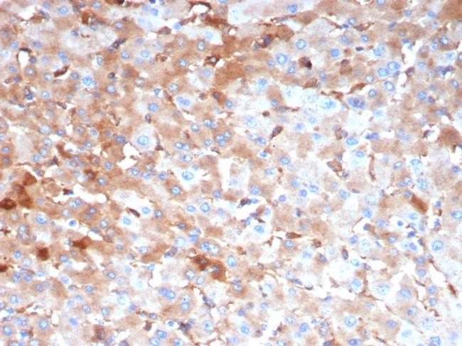 Alpha-2-Macroglobulin/A2M Antibody in Immunohistochemistry (Paraffin) (IHC (P))