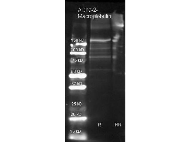 alpha-2-Macroglobulin Antibody in Western Blot (WB)