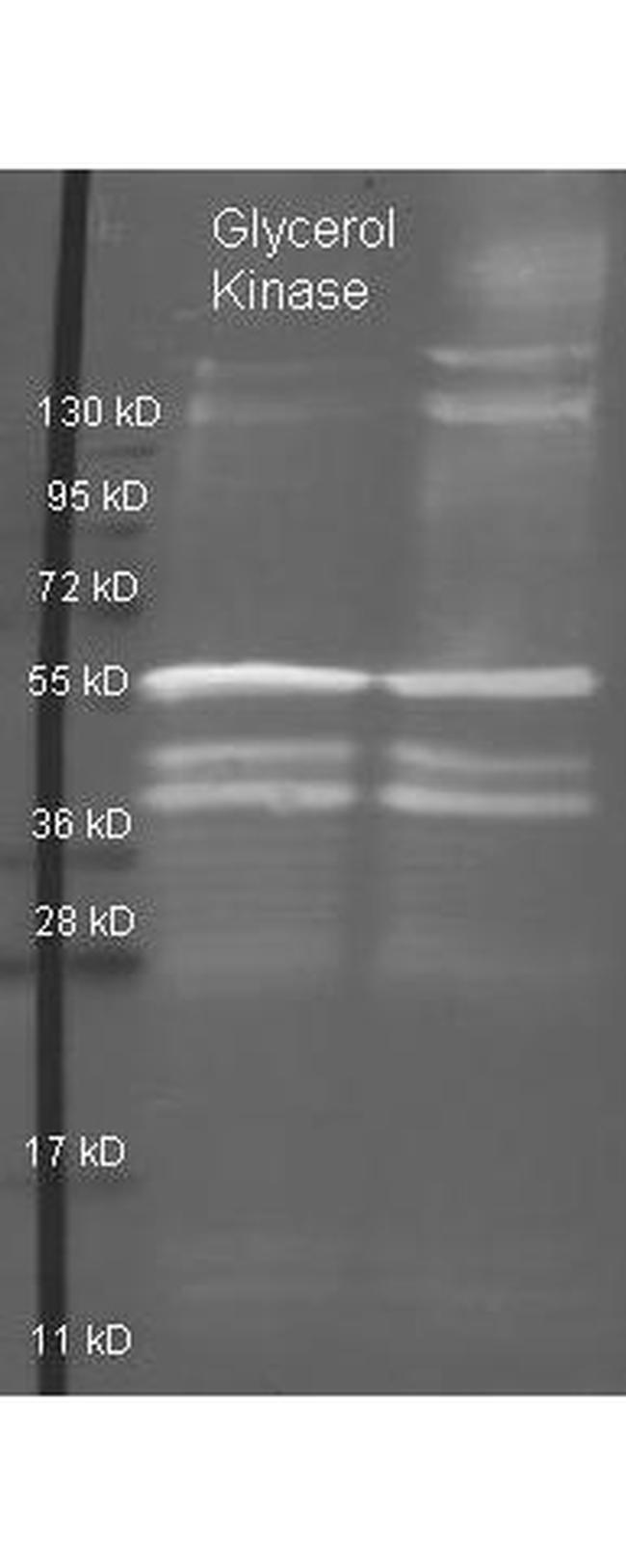 Glycerol Kinase Antibody in Western Blot (WB)