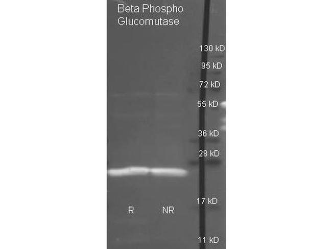 beta-Phosphoglucomutase Antibody in Western Blot (WB)