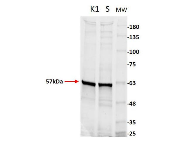 Pyruvate Kinase Antibody in Western Blot (WB)