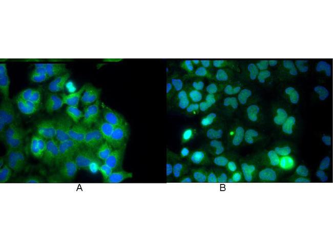 NFkB p65 Antibody in Immunocytochemistry (ICC/IF)