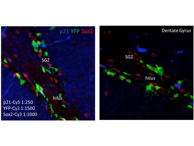 p21 WAF1 Antibody in Immunohistochemistry (IHC)