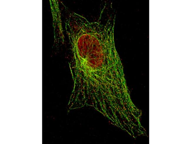 Phospho-Stat5 (Tyr694) Antibody in Immunocytochemistry (ICC/IF)