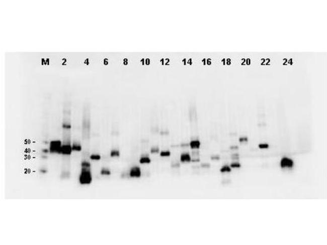 DYKDDDDK Antibody in Western Blot (WB)