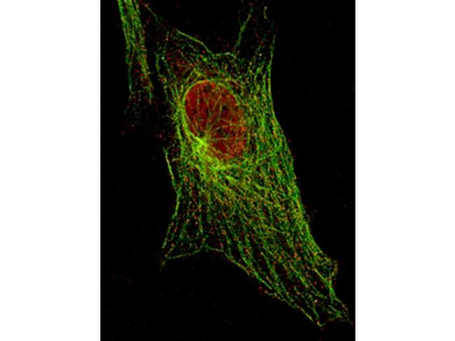 Phospho-Stat5 (Ser694) Antibody in Immunocytochemistry (ICC/IF)