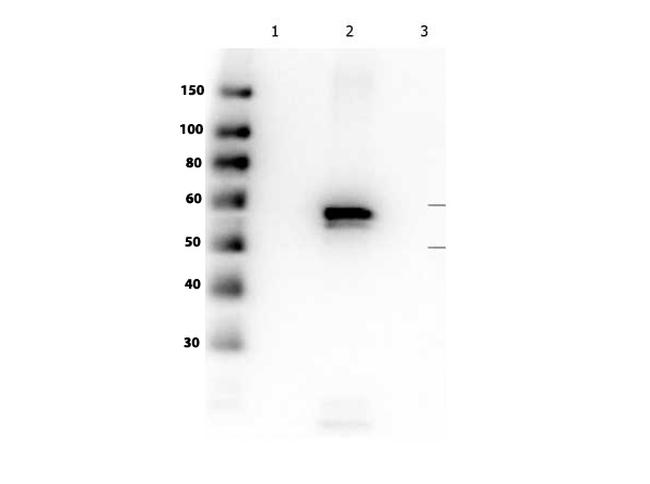 AKT2 Antibody in Western Blot (WB)