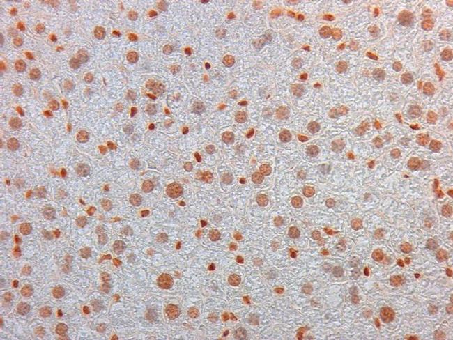 AKT3 Antibody in Immunohistochemistry (Paraffin) (IHC (P))