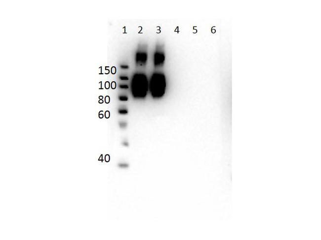 Hemoglobin A (beta chain) Antibody in Western Blot (WB)