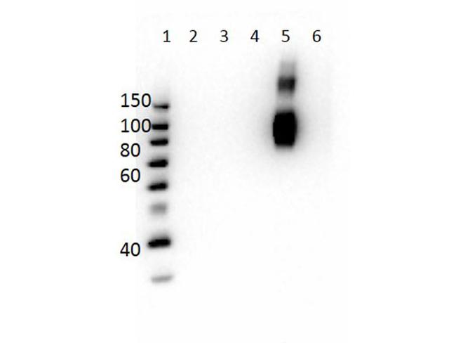 Hemoglobin beta F Antibody in Western Blot (WB)