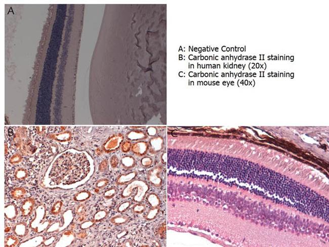 Carbonic Anhydrase II Antibody in Immunohistochemistry (Paraffin) (IHC (P))