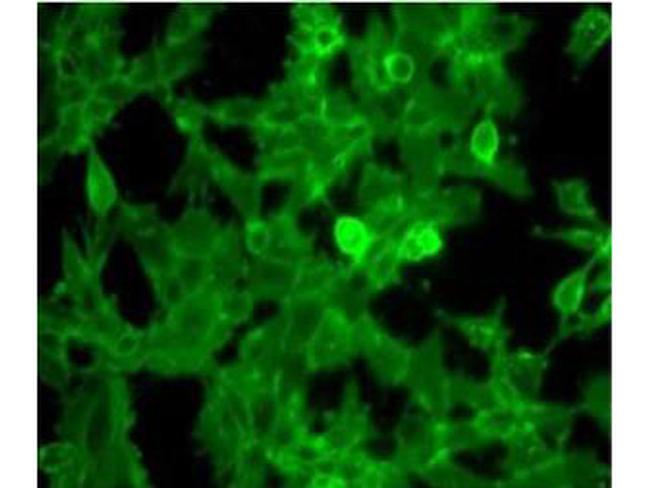 beta-2-Microglobulin Antibody in Immunocytochemistry (ICC/IF)