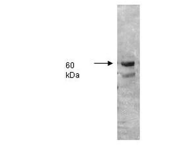 Alkaline Phosphatase Antibody in Western Blot (WB)