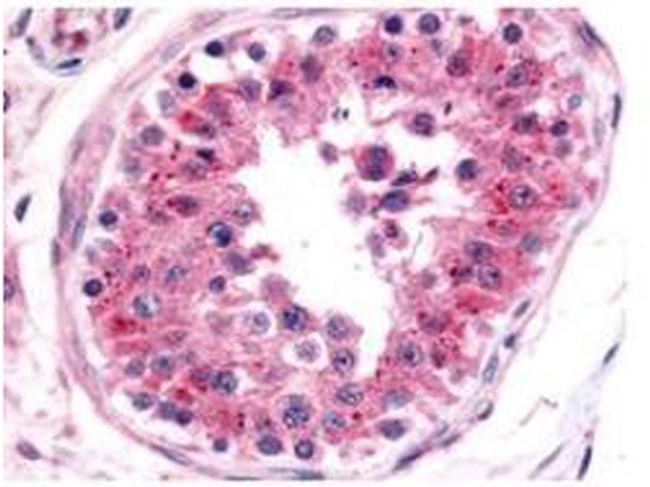 NRF1 Antibody in Immunohistochemistry (Paraffin) (IHC (P))