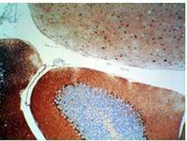 S100 Protein Antibody in Immunohistochemistry (Paraffin) (IHC (P))