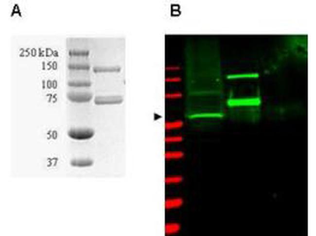 SAE1 Antibody in Western Blot (WB)