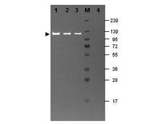 beta Galactosidase Antibody in Western Blot (WB)