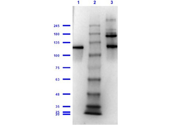 beta Galactosidase Antibody in Western Blot (WB)