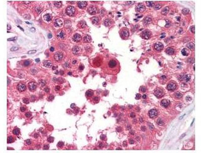 Aha1 Antibody in Immunohistochemistry (Paraffin) (IHC (P))