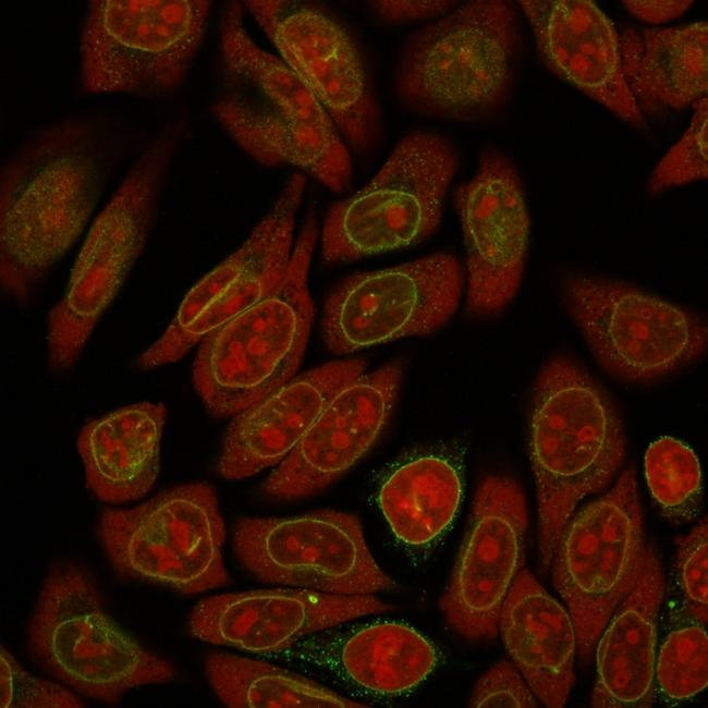 Emerin Antibody in Immunocytochemistry (ICC/IF)