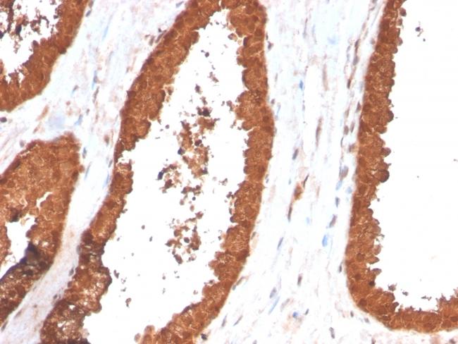 TIGIT/VSTM3/VSIG9 (Immune Checkpoint for Cancer) Antibody in Immunohistochemistry (Paraffin) (IHC (P))