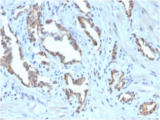 TIGIT/VSTM3/VSIG9 (Immune Checkpoint for Cancer) Antibody in Immunohistochemistry (Paraffin) (IHC (P))