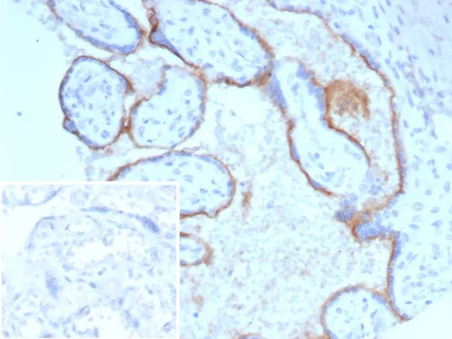 Endoglin/CD105 (Angiogenesis Marker) Antibody in Immunohistochemistry (Paraffin) (IHC (P))